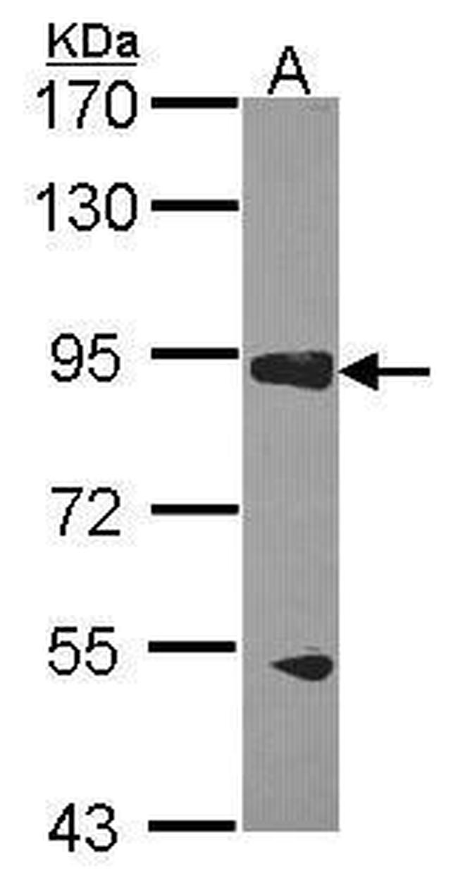 RASA3 Antibody in Western Blot (WB)