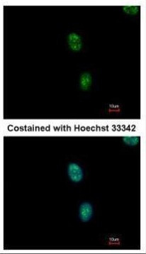 SAP130 Antibody in Immunocytochemistry (ICC/IF)