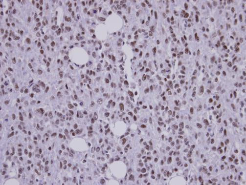 SAP130 Antibody in Immunohistochemistry (Paraffin) (IHC (P))