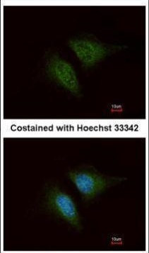 Coronin 3 Antibody in Immunocytochemistry (ICC/IF)