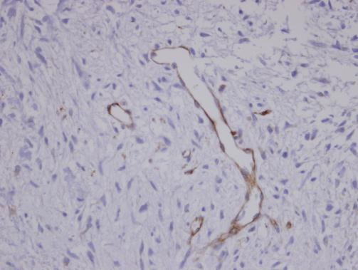 Coronin 3 Antibody in Immunohistochemistry (Paraffin) (IHC (P))