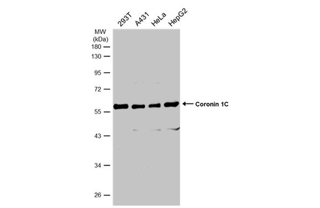 Coronin 3 Antibody in Western Blot (WB)