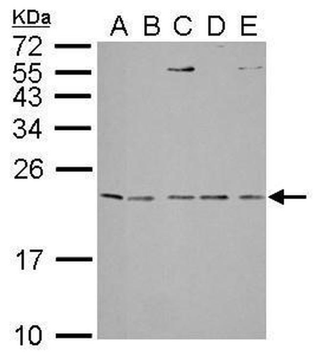 IL1RA Antibody in Western Blot (WB)