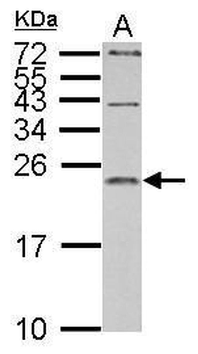 IL1RA Antibody in Western Blot (WB)