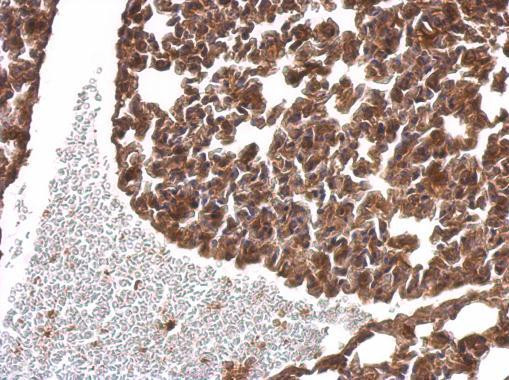 SNAP alpha Antibody in Immunohistochemistry (Paraffin) (IHC (P))