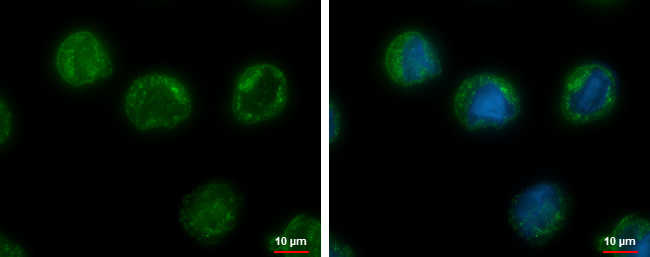 CHMP5 Antibody in Immunocytochemistry (ICC/IF)