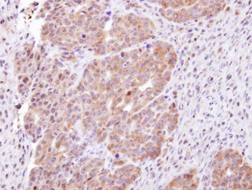 CHMP5 Antibody in Immunohistochemistry (Paraffin) (IHC (P))