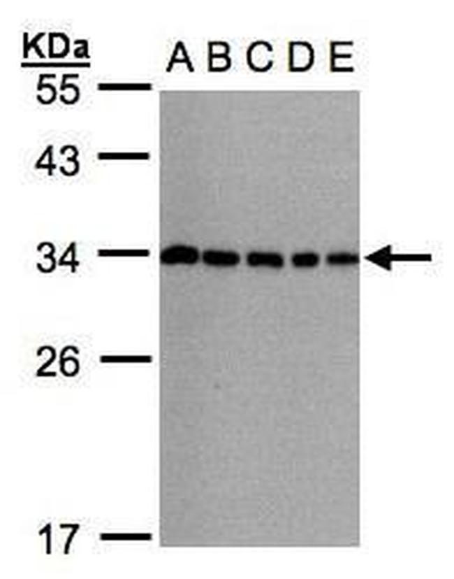 CHMP5 Antibody in Western Blot (WB)