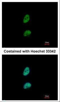 PSME3 Antibody in Immunocytochemistry (ICC/IF)