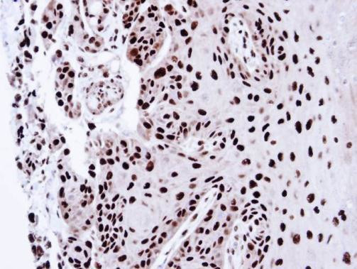 PSME3 Antibody in Immunohistochemistry (Paraffin) (IHC (P))