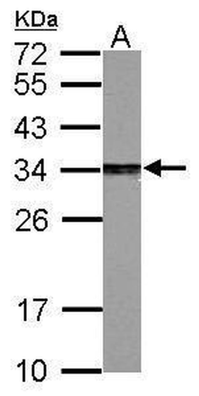 PSME3 Antibody in Western Blot (WB)