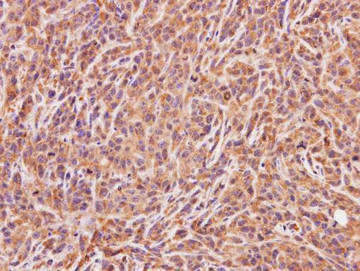 ACMSD Antibody in Immunohistochemistry (Paraffin) (IHC (P))