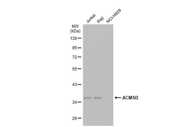 ACMSD Antibody in Western Blot (WB)