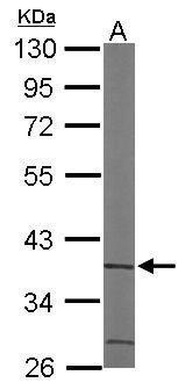 ACMSD Antibody in Western Blot (WB)