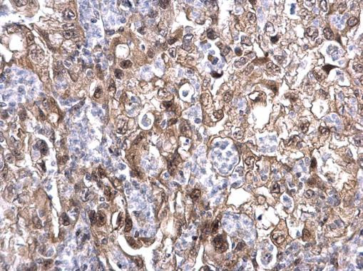 MAF1 Antibody in Immunohistochemistry (Paraffin) (IHC (P))