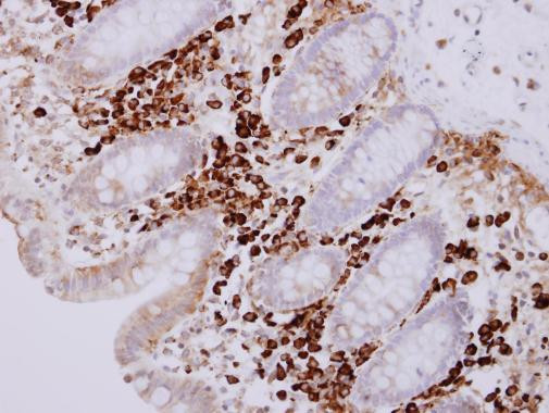 MZB1 Antibody in Immunohistochemistry (Paraffin) (IHC (P))