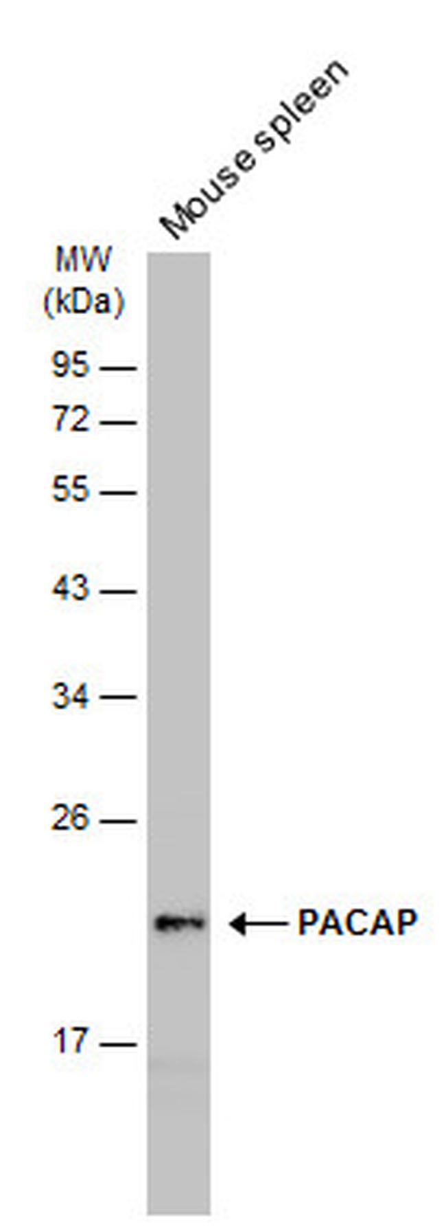 MZB1 Antibody in Western Blot (WB)