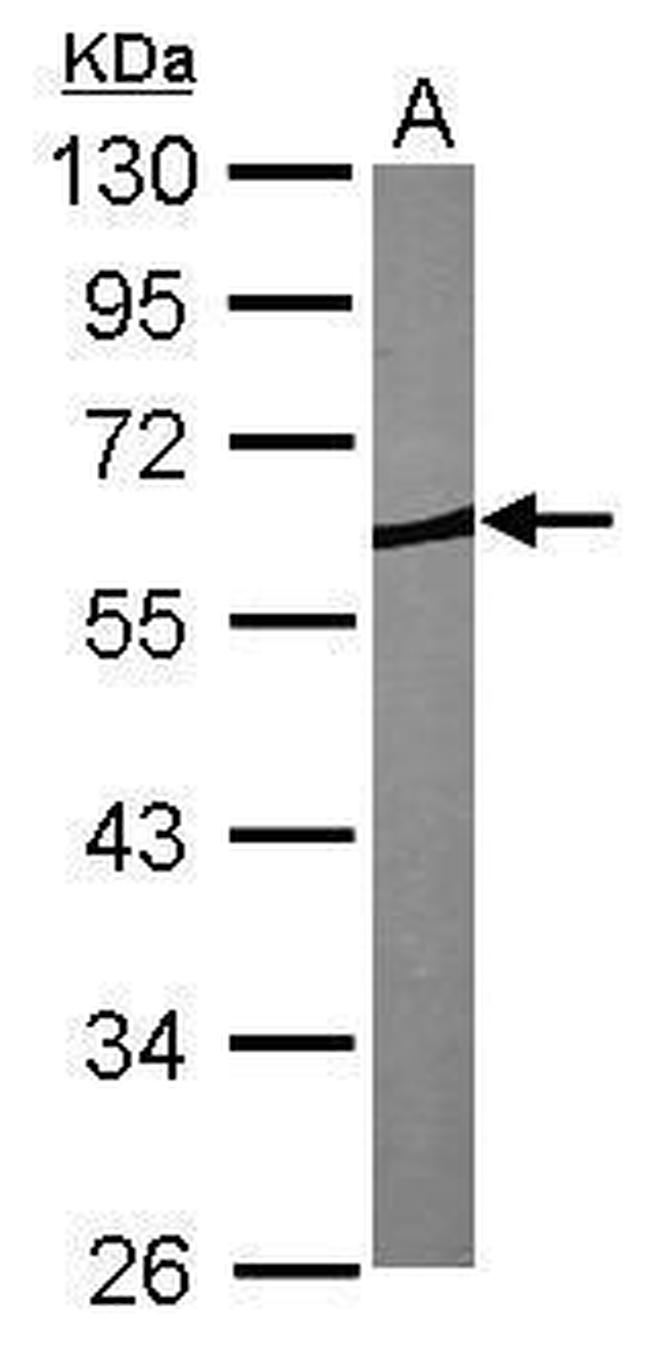 Coronin 1B Antibody in Western Blot (WB)