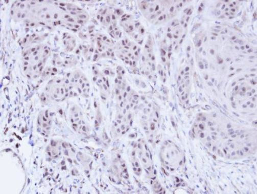 SCMH1 Antibody in Immunohistochemistry (Paraffin) (IHC (P))