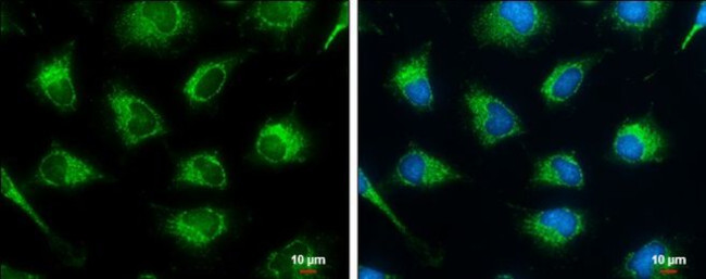 SUCLG2 Antibody in Immunocytochemistry (ICC/IF)