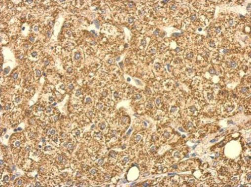 SUCLG2 Antibody in Immunohistochemistry (Paraffin) (IHC (P))