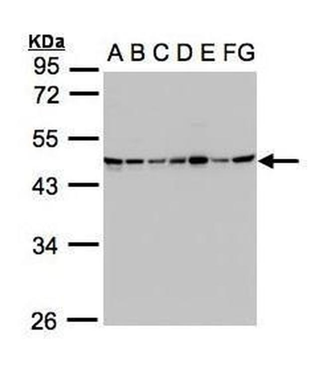 SUCLG2 Antibody in Western Blot (WB)