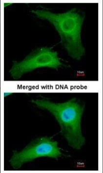 PHLP Antibody in Immunocytochemistry (ICC/IF)