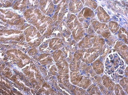 PHLP Antibody in Immunohistochemistry (Paraffin) (IHC (P))