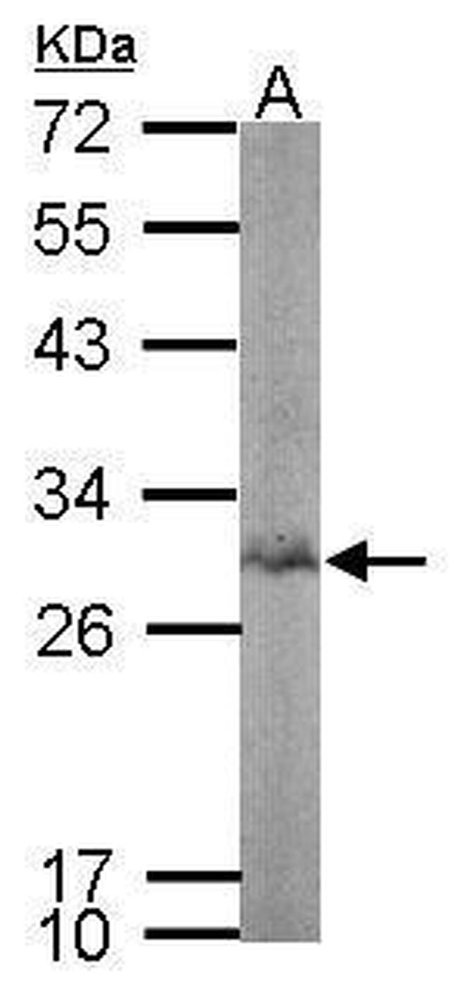 Bisphosphoglycerate mutase Antibody in Western Blot (WB)