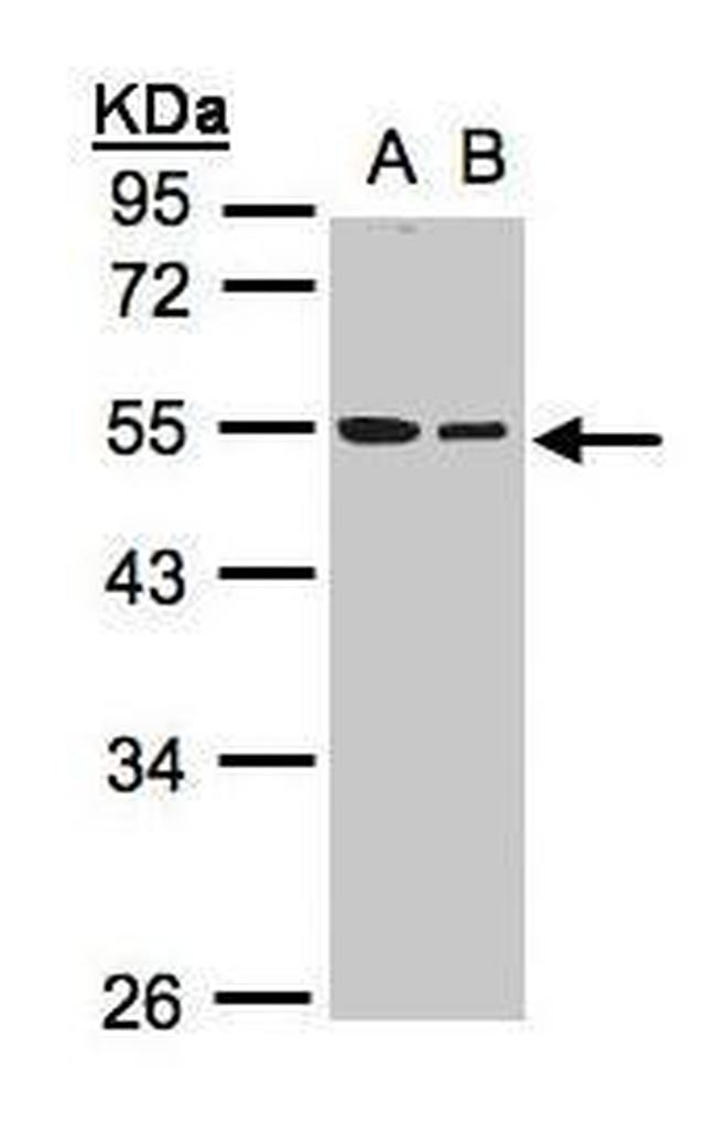 beta Tubulin Antibody in Western Blot (WB)