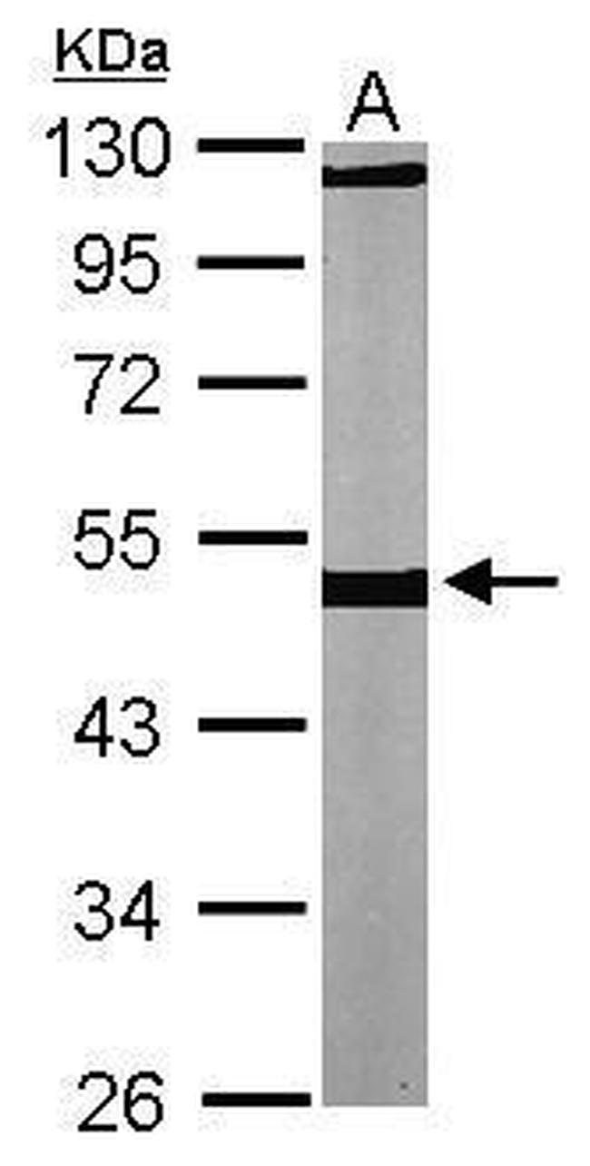 beta Tubulin Antibody in Western Blot (WB)