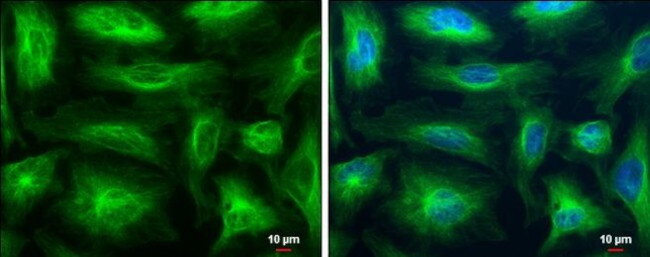 beta Tubulin Antibody in Immunocytochemistry (ICC/IF)