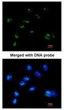 RASSF2 Antibody in Immunocytochemistry (ICC/IF)