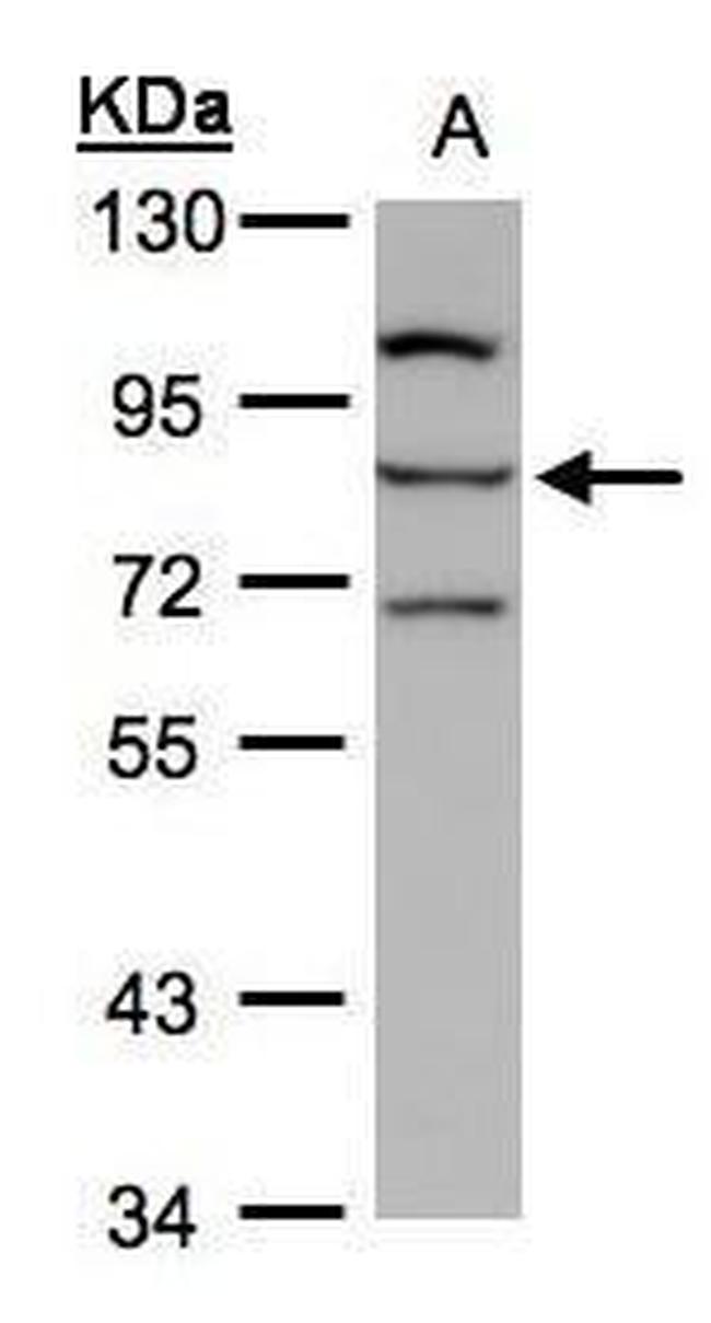 ALOXE3 Antibody in Western Blot (WB)