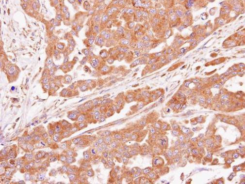 ASB4 Antibody in Immunohistochemistry (Paraffin) (IHC (P))