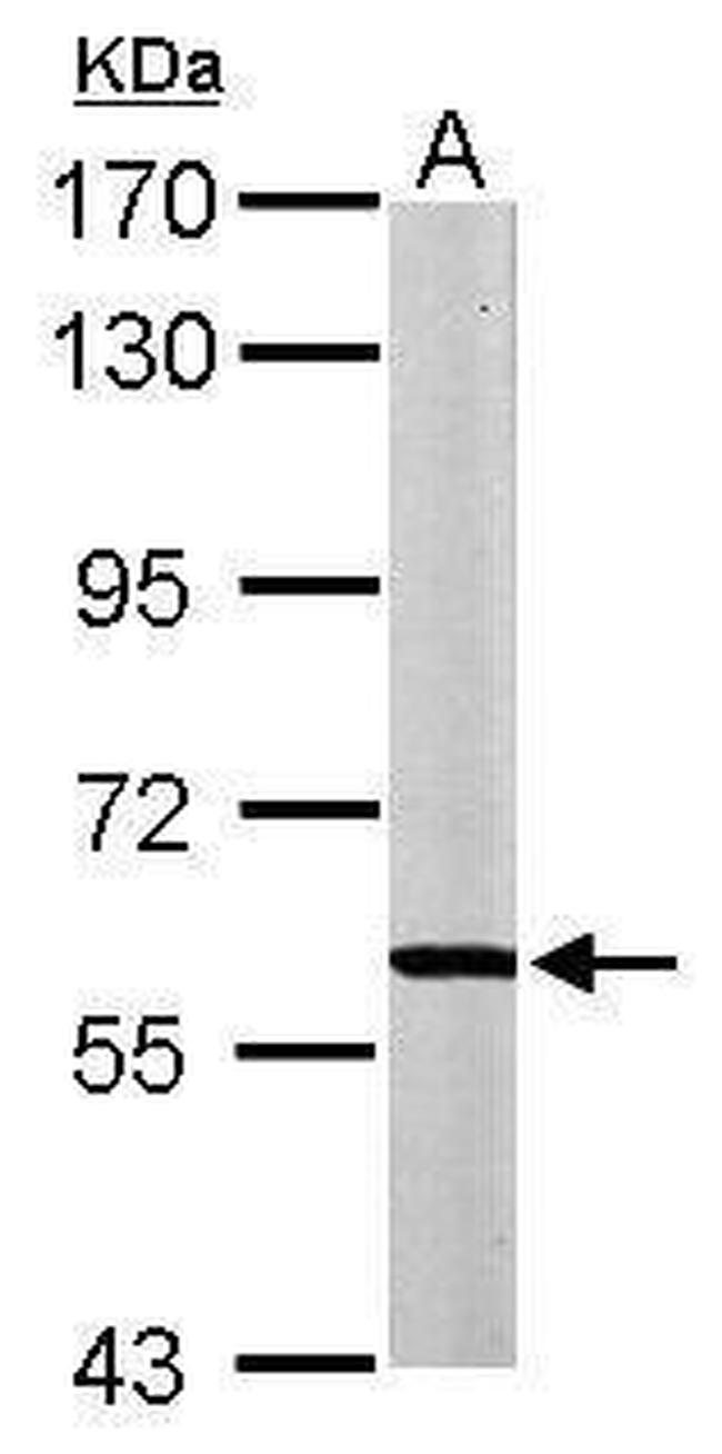 MPP2 Antibody in Western Blot (WB)