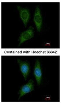 STK25 Antibody in Immunocytochemistry (ICC/IF)