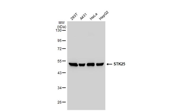 STK25 Antibody in Western Blot (WB)