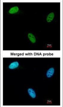 DCK Antibody in Immunocytochemistry (ICC/IF)