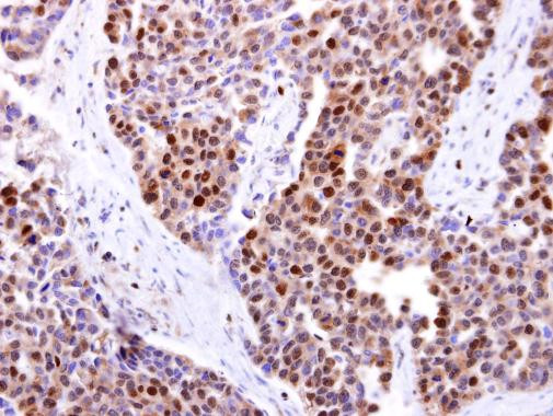 DCK Antibody in Immunohistochemistry (Paraffin) (IHC (P))