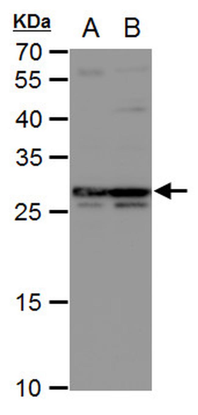 DCK Antibody in Western Blot (WB)