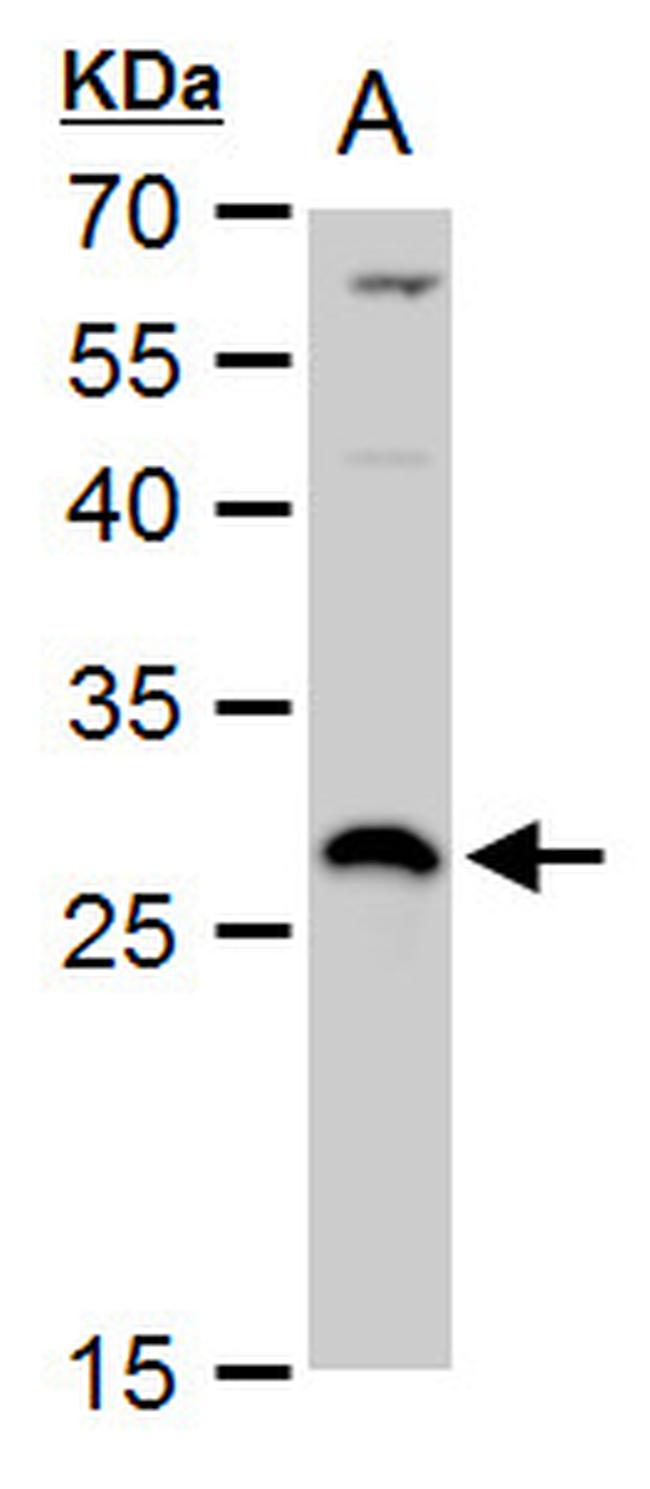 DCK Antibody in Western Blot (WB)