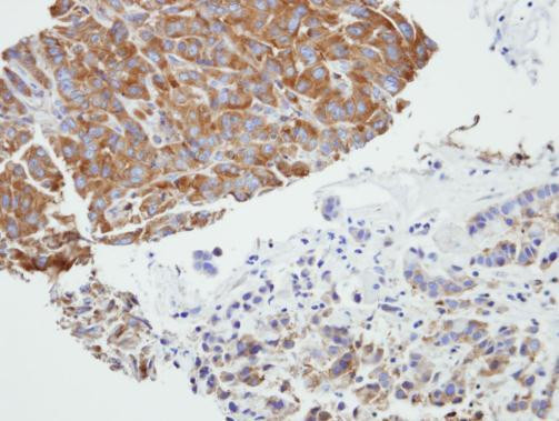 PRPSAP2 Antibody in Immunohistochemistry (Paraffin) (IHC (P))