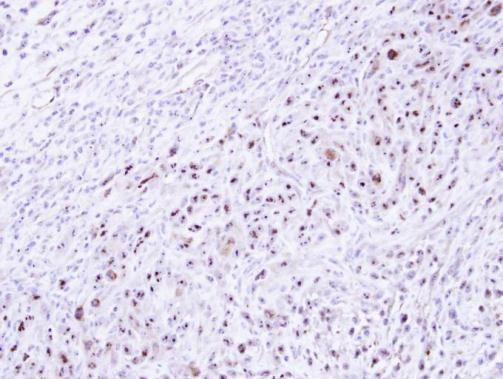 DRAK1 Antibody in Immunohistochemistry (Paraffin) (IHC (P))