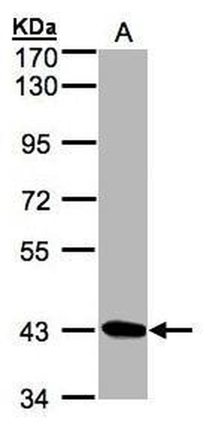 DRAK1 Antibody in Western Blot (WB)