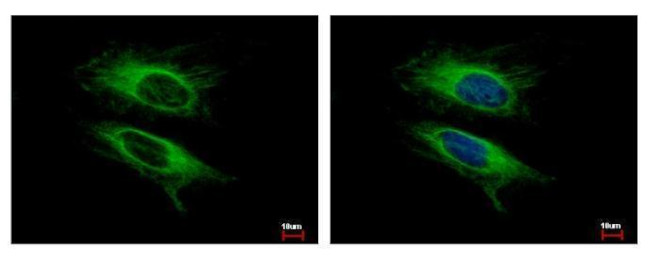 VPS11 Antibody in Immunocytochemistry (ICC/IF)