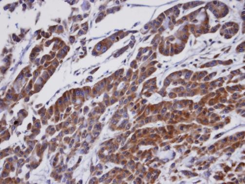 ORP1 Antibody in Immunohistochemistry (Paraffin) (IHC (P))