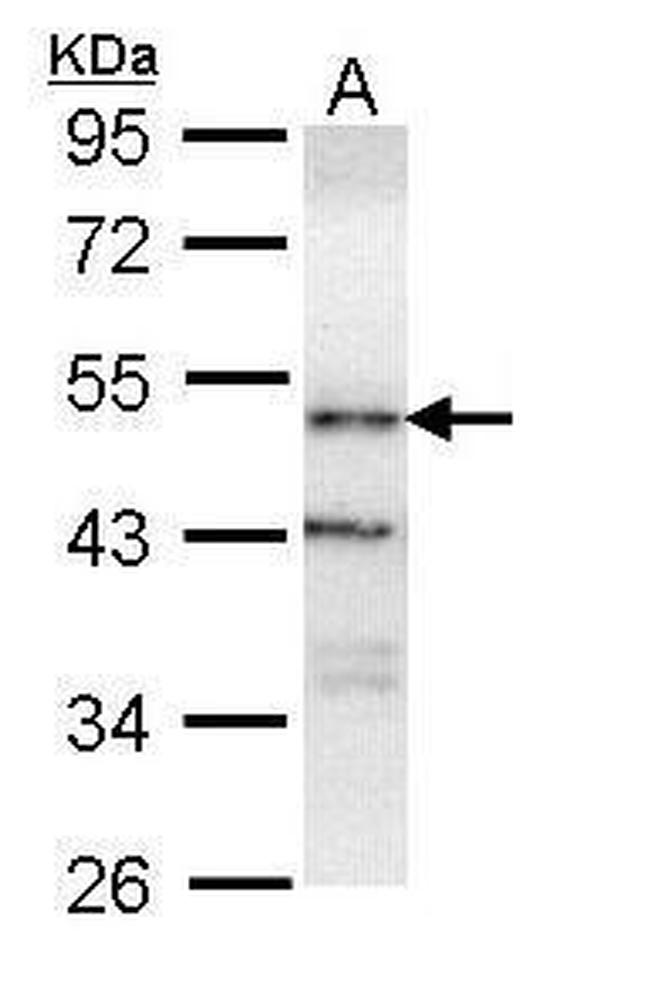 ORP1 Antibody in Western Blot (WB)