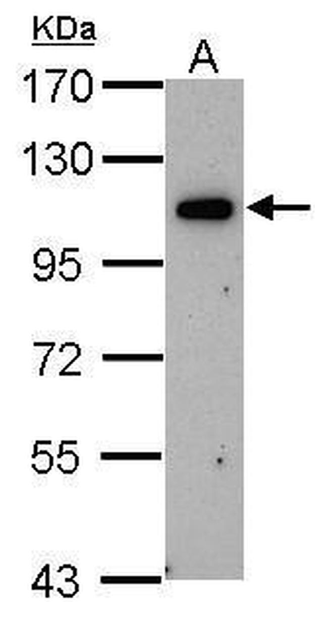 ORP6 Antibody in Western Blot (WB)