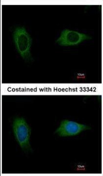 EVC2 Antibody in Immunocytochemistry (ICC/IF)